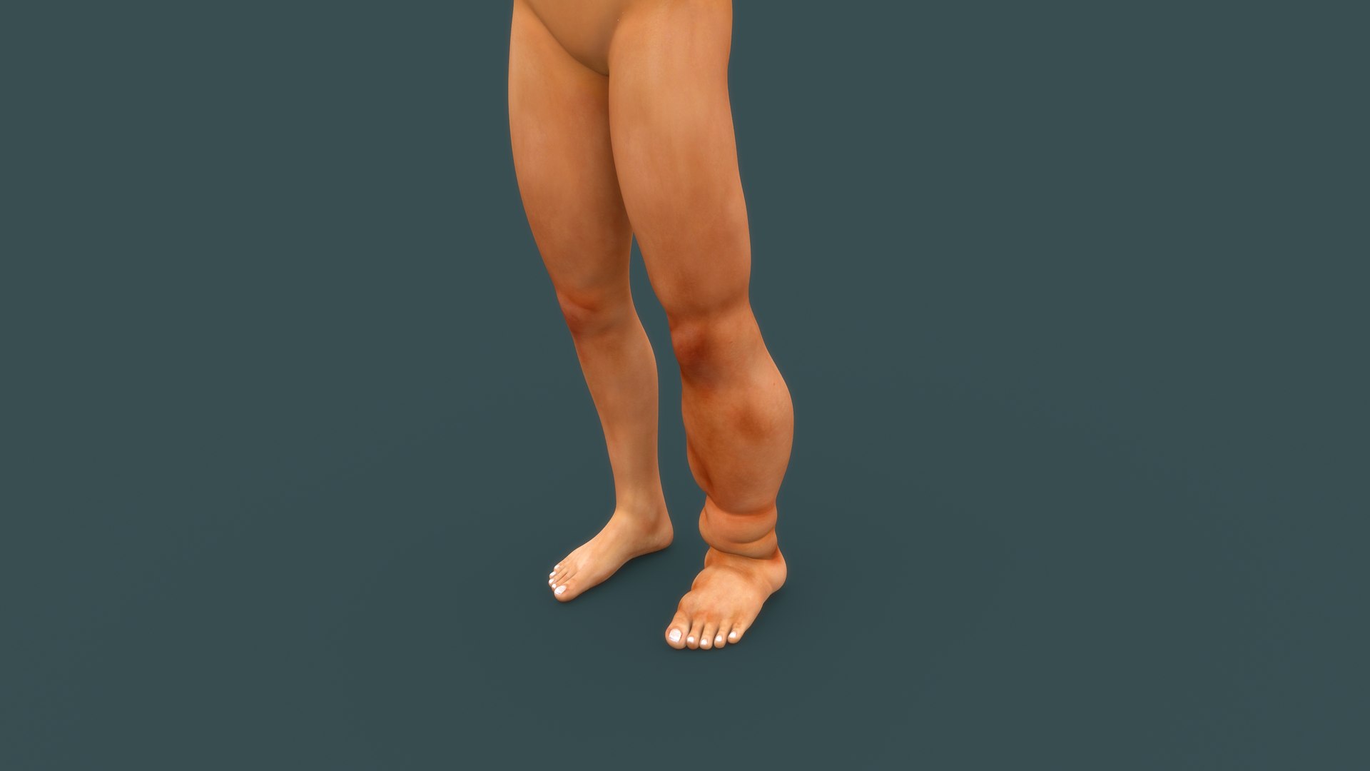 Lymphatic filariasis model https://p.turbosquid.com/ts-thumb/dn/EPqSk1/wU/b0723filariasis_pers/jpg/1632467680/1920x1080/fit_q87/fe4efe81a985b16fd1b7877b06255318a8e131b4/b0723filariasis_pers.jpg