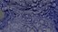 Cancer Cells Brain 9