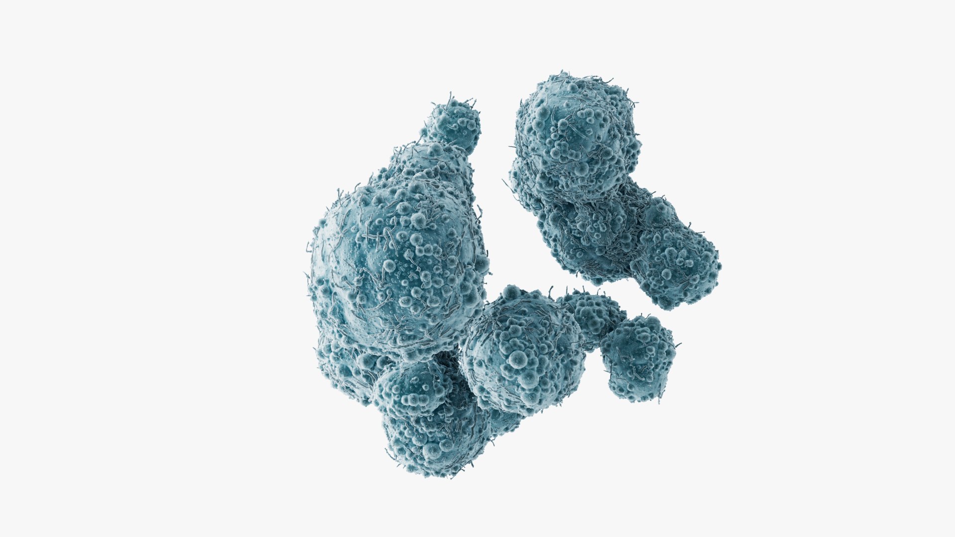3D model Cancer Cells Brain 9 https://p.turbosquid.com/ts-thumb/dv/2A0qnr/FL/images_003/jpg/1717068049/1920x1080/fit_q87/98301e9949438b23a246c2630913de9d5215b251/images_003.jpg