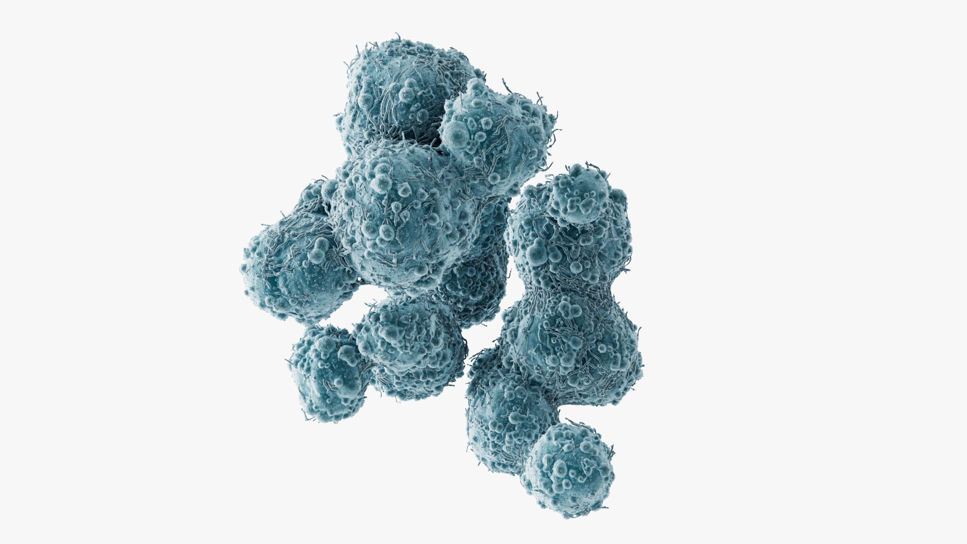 3D model Cancer Cells Brain 9 https://p.turbosquid.com/ts-thumb/dv/2A0qnr/JD/images_001/jpg/1717068045/1920x1080/fit_q87/1852c04a4d9679d1678c2f8f8d1fac8a5d21bf76/images_001.jpg