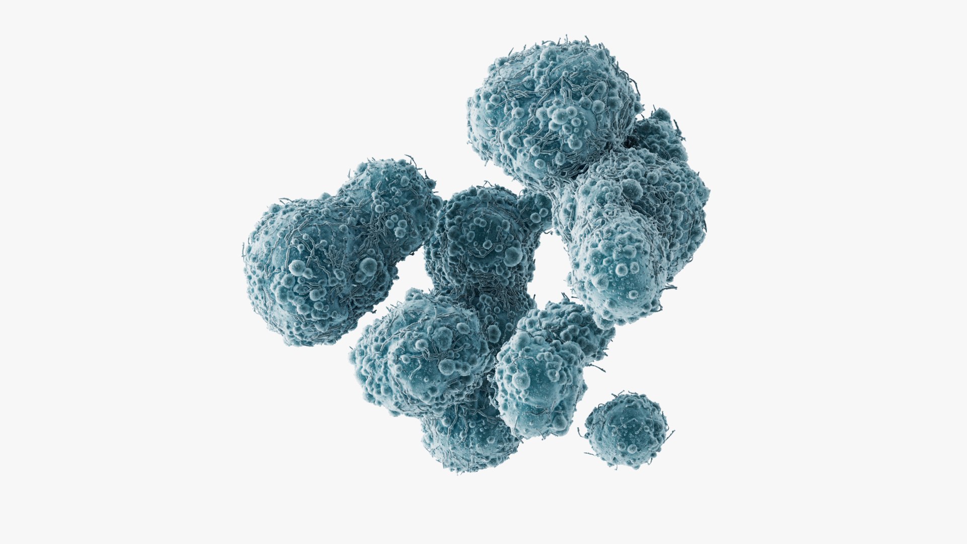 3D model Cancer Cells Brain 9 https://p.turbosquid.com/ts-thumb/dv/2A0qnr/ob/images_002/jpg/1717068047/1920x1080/fit_q87/d419f5f77c68b682c19de6fe0353a1fd459b016c/images_002.jpg