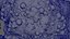 Cancer Cells Brain 9