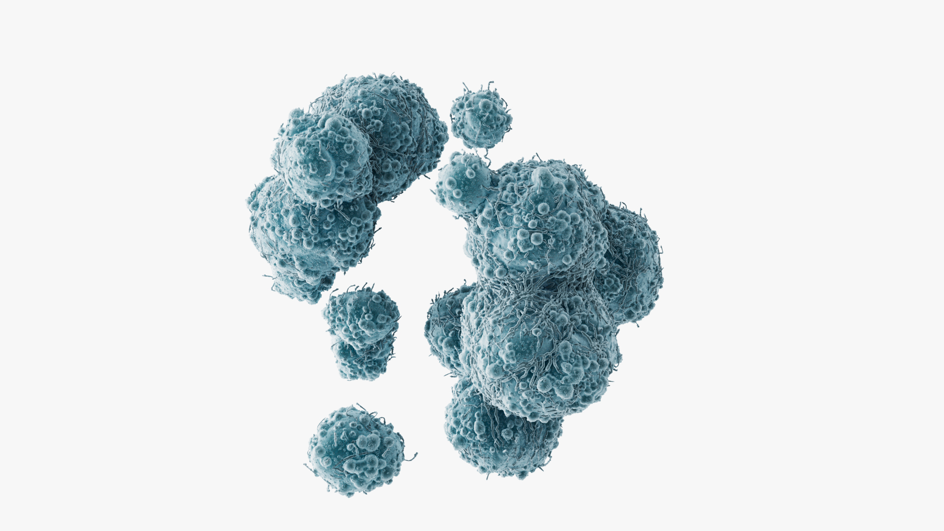 3D model Cancer Cells Brain 9 https://p.turbosquid.com/ts-thumb/dv/2A0qnr/pN/turntable/jpg/1717068099/1920x1080/turn_fit_q99/a3409ca40d96b5bd8065ce27e9d62245b757ffd9/turntable-1.jpg