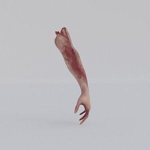 3D Accident hand