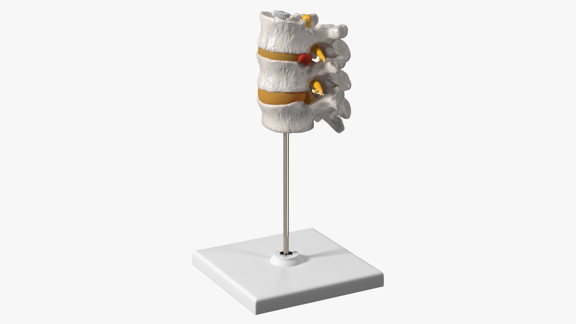 Herniated Vertebrae on Medical Stand 3D model preview