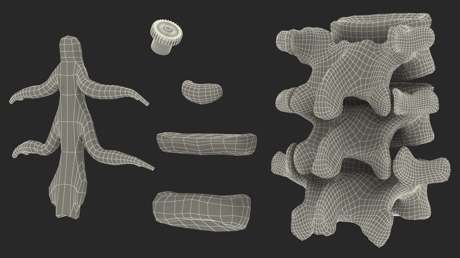 3D Herniated Vertebrae on Medical Stand model - TurboSquid 2044661