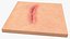 Cut Skin Surface