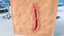 Cut Skin Surface