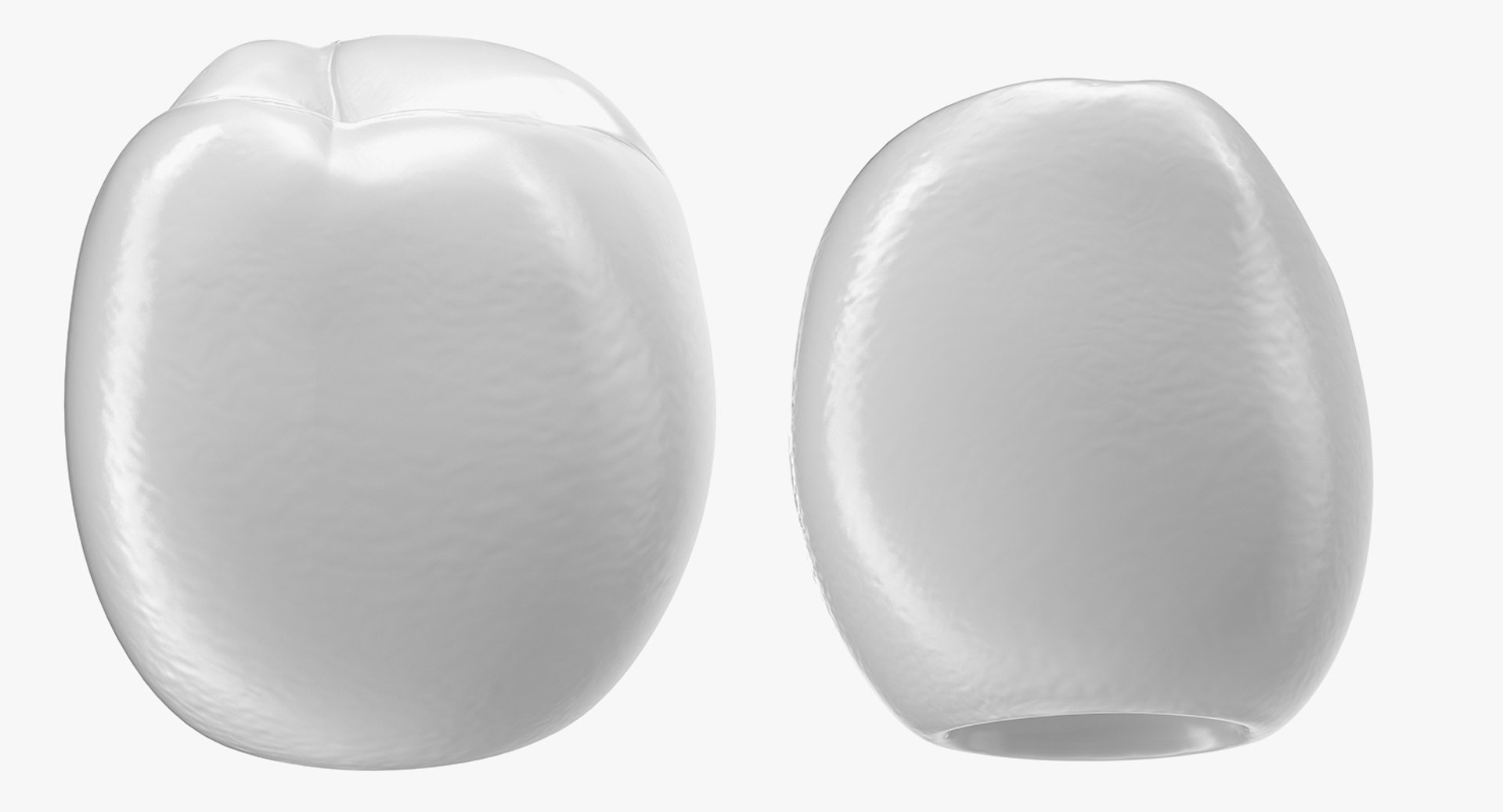 3D dental crown model https://p.turbosquid.com/ts-thumb/eb/aE9SNs/DEVSiKow/dentalcrownmb3dmodel003/jpg/1563823765/1920x1080/fit_q87/160340bc063b760449b3341d14599a64739db78f/dentalcrownmb3dmodel003.jpg
