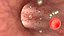 virus infection in blood stream