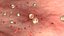 virus infection in blood stream