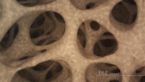 3D bone structure 360