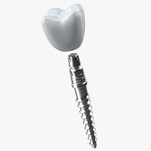 KOS Series Dental Implants model