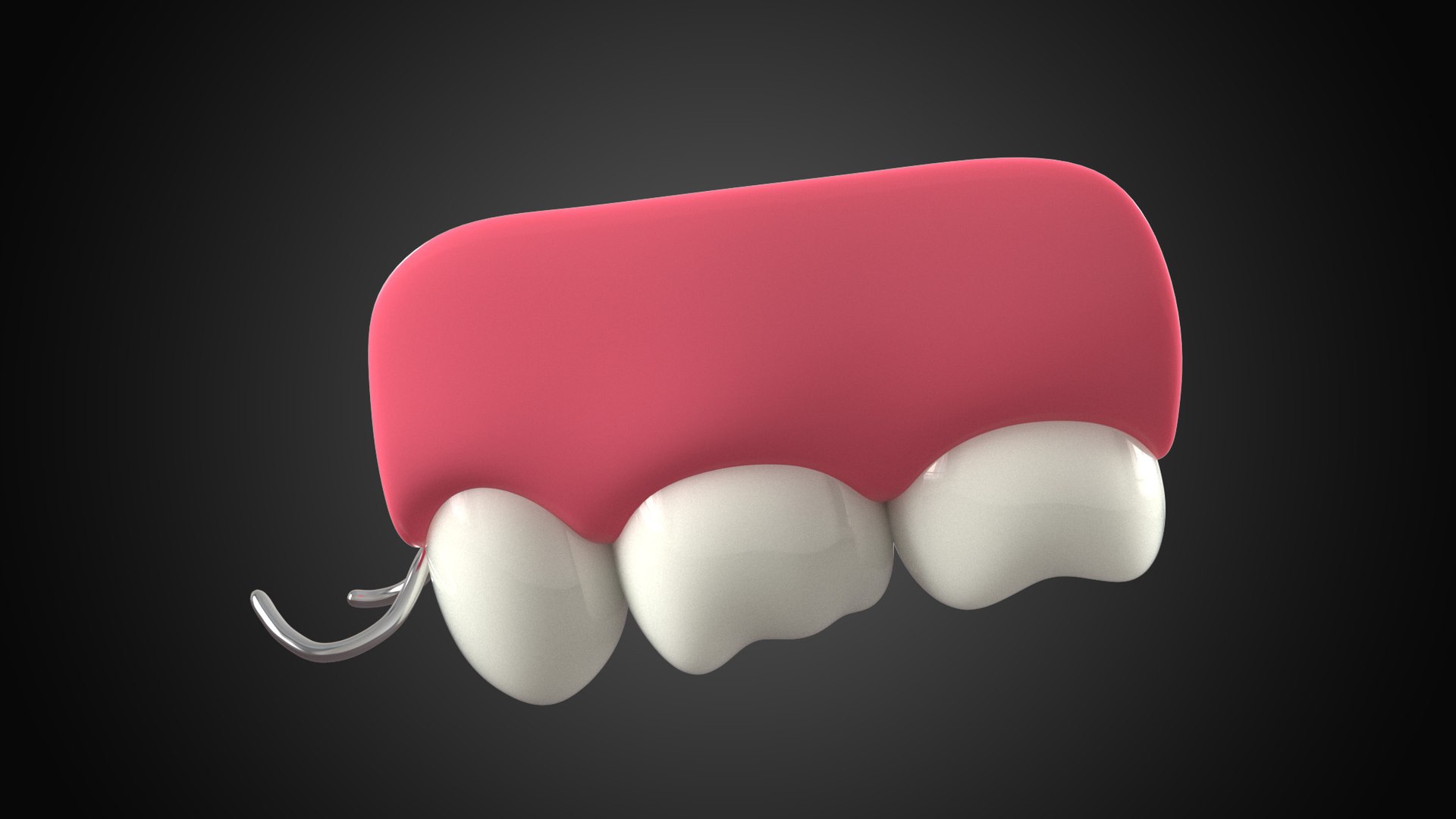 Removable Partial Denture 3D https://p.turbosquid.com/ts-thumb/et/FfuJAc/Ae/protesis1_4/jpg/1745382911/1920x1080/fit_q87/5e1e9542caabee4469a56fc801536c2650a562f2/protesis1_4.jpg