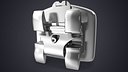 Self Ligating Dental Braces Bracket V01