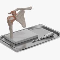 Anatomical Model of Shoulder Joint with Volkmann Bone Curette