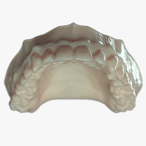 Upper Denture B mold