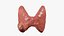 Thyroid cancer 3D model