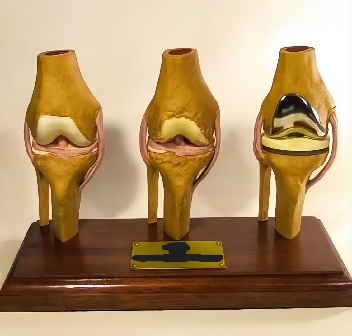Modular 3D Knee Study Model Model - TurboSquid 2536450