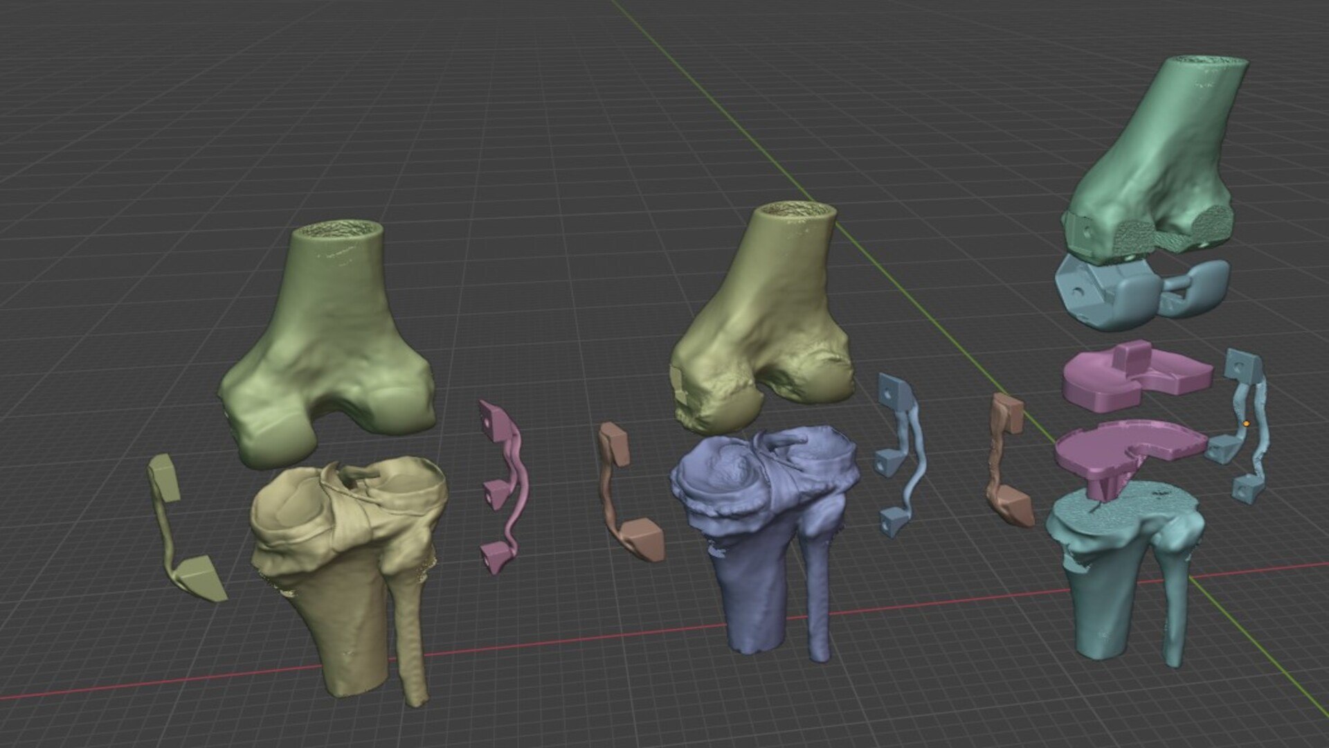 Modular 3D Knee Study Model Model - TurboSquid 2536450