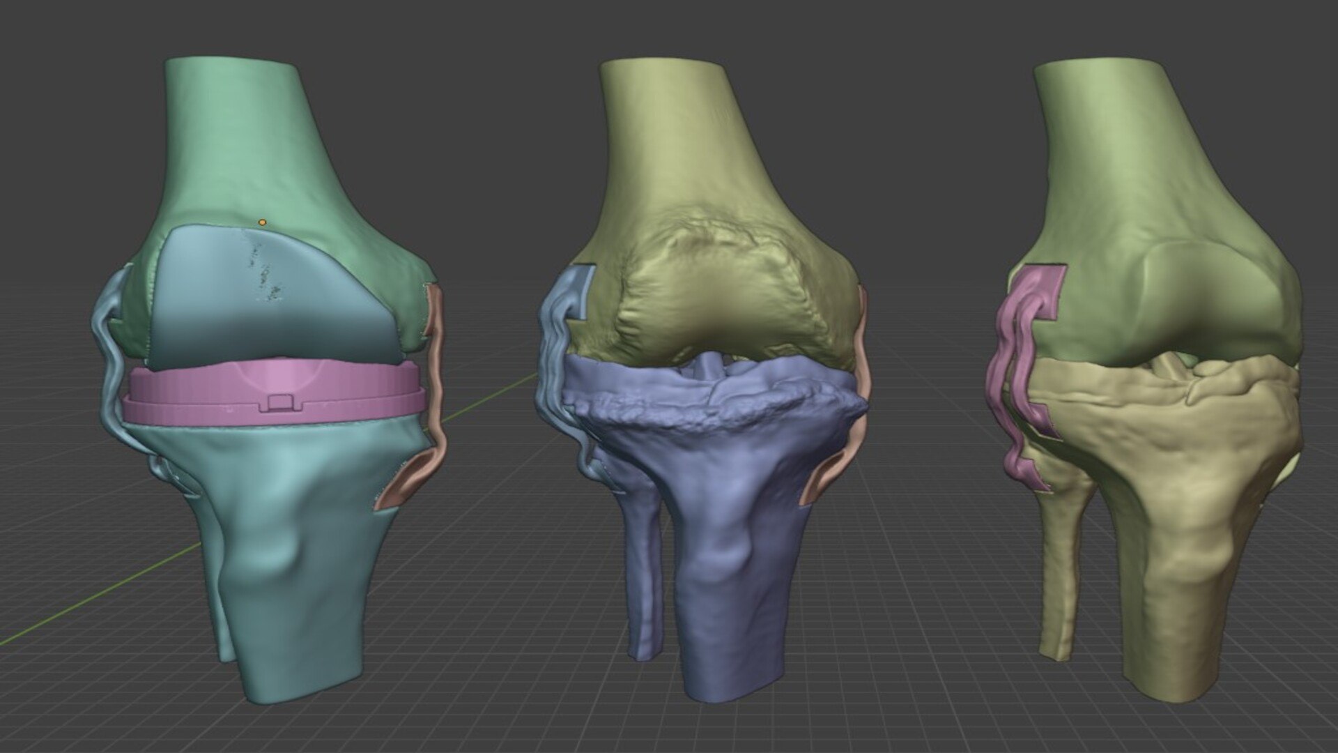 Modular 3D Knee Study Model Model - TurboSquid 2536450