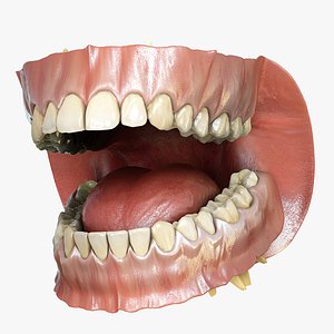 3d model orthodontics mouth teeth