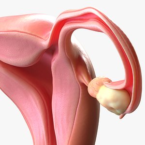 3D model Female Reproductive System Cyst