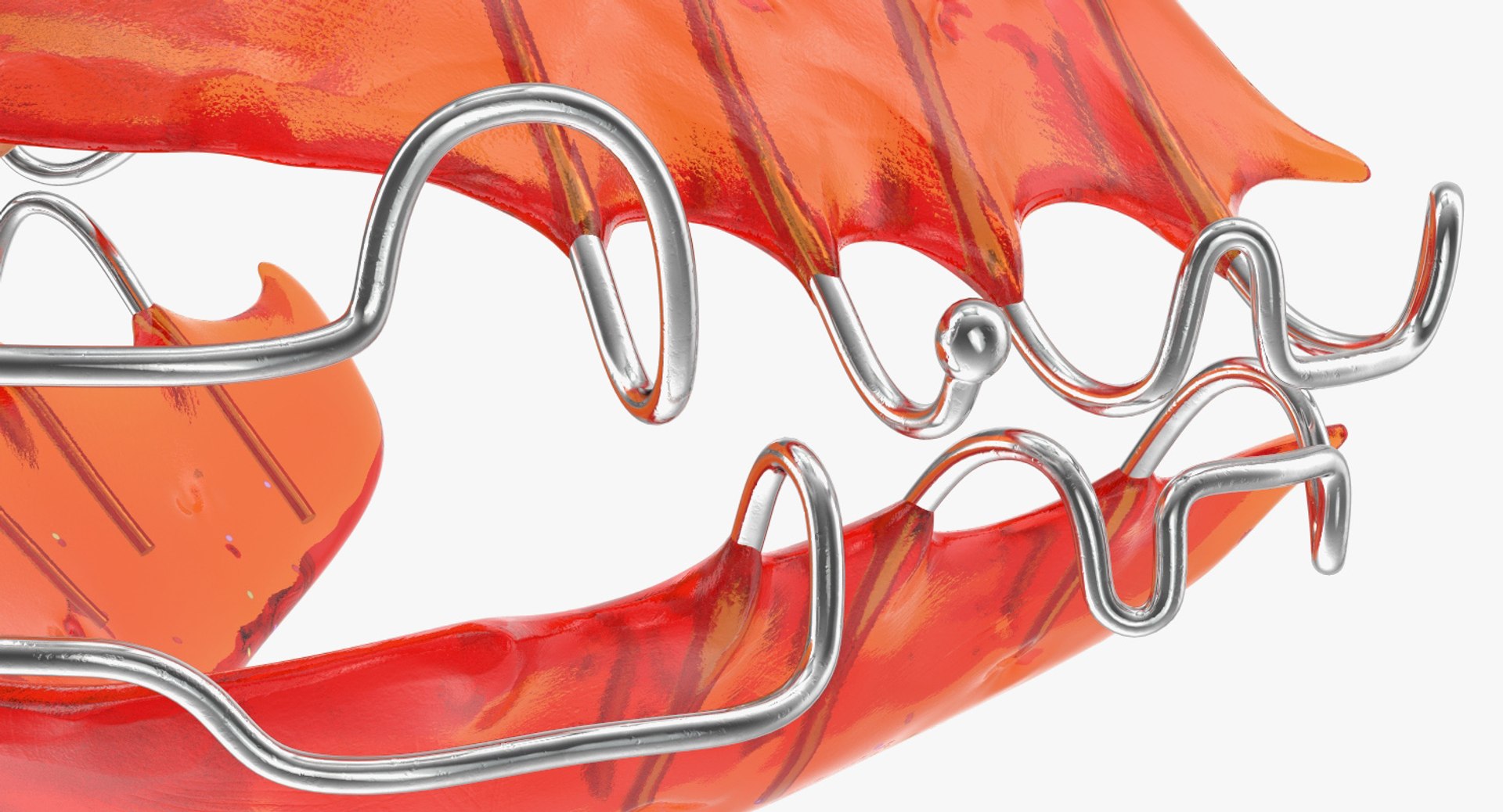 3D dental tooth retainer https://p.turbosquid.com/ts-thumb/gG/TVwQox/f3RCtUrZ/dentaltoothretainervray3dmodel010/jpg/1534307309/1920x1080/fit_q87/5d78c862409b4a3b7f2358c43d6cea62d5b59d2a/dentaltoothretainervray3dmodel010.jpg