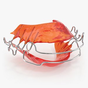 Dental Tooth Retainer