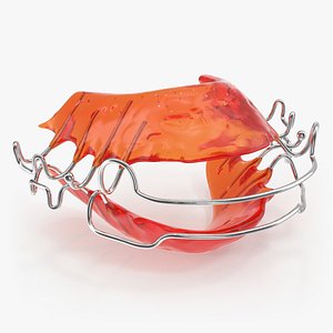 Dental Tooth Retainer