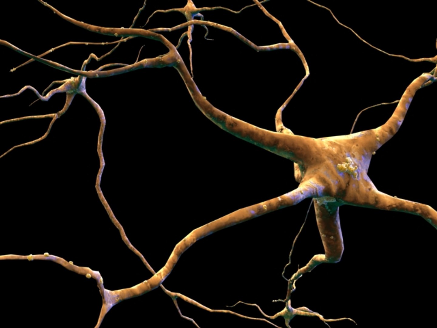 neurons cells max https://p.turbosquid.com/ts-thumb/gQ/wj6AnW/EyDdze80/neuronsonlynobackgd/jpg/1195440781/1920x1080/fit_q87/f58aaf13783059cbb93214ad5754aaea5985c476/neuronsonlynobackgd.jpg