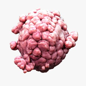 Cancer Cell Tumor