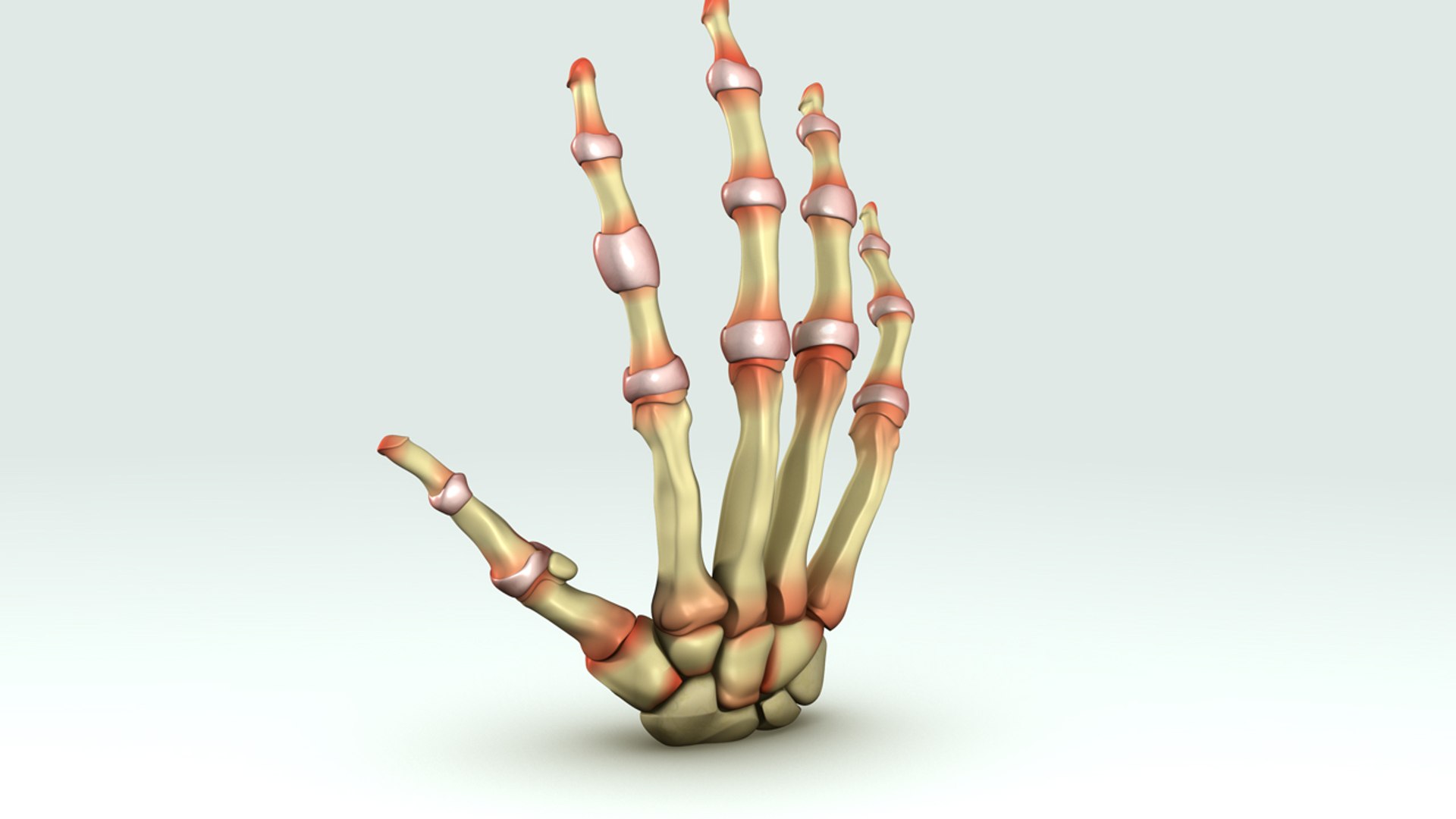 rheumatoid arthritis 3d model