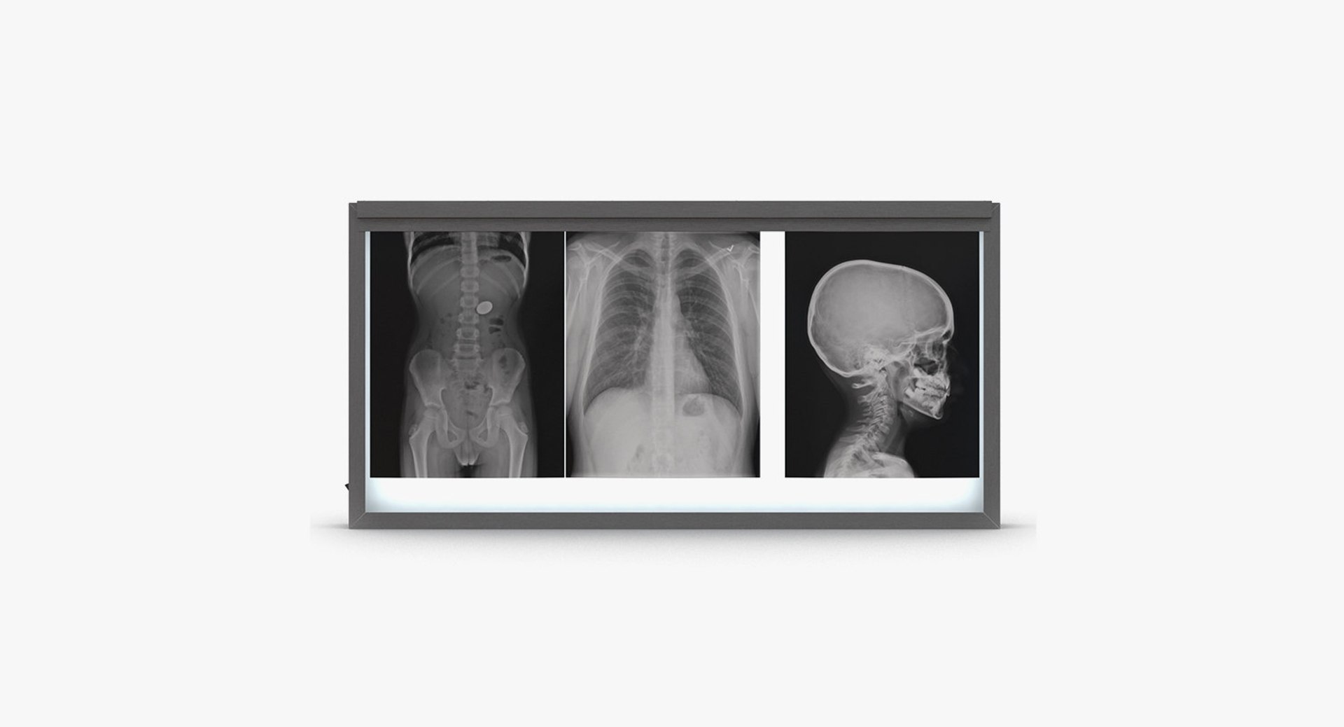 3D medical equipment 5 https://p.turbosquid.com/ts-thumb/go/RRXSsL/U4k28FPI/medicalequipmentcollection53dmodel171/jpg/1582960305/1920x1080/fit_q87/1ef75349c30ee85b2fc5c95b4841909b733792c3/medicalequipmentcollection53dmodel171.jpg