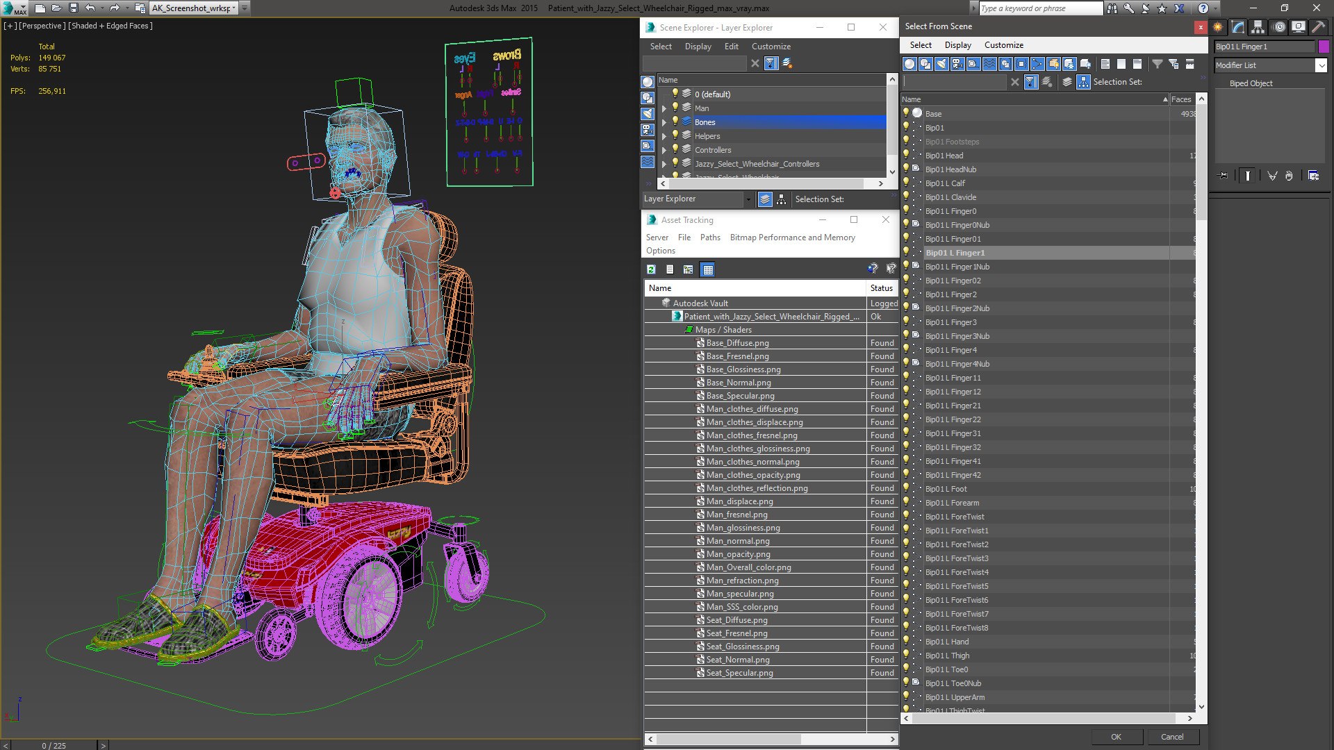Patient with Jazzy Select Wheelchair Rigged 3D https://p.turbosquid.com/ts-thumb/gv/bX0ypd/Zw/patientwithjazzyselectwheelchairriggedvray3dmodel026/jpg/1654783807/1920x1080/fit_q87/b9979fb91f3504522347e471c63097697d521364/patientwithjazzyselectwheelchairriggedvray3dmodel026.jpg