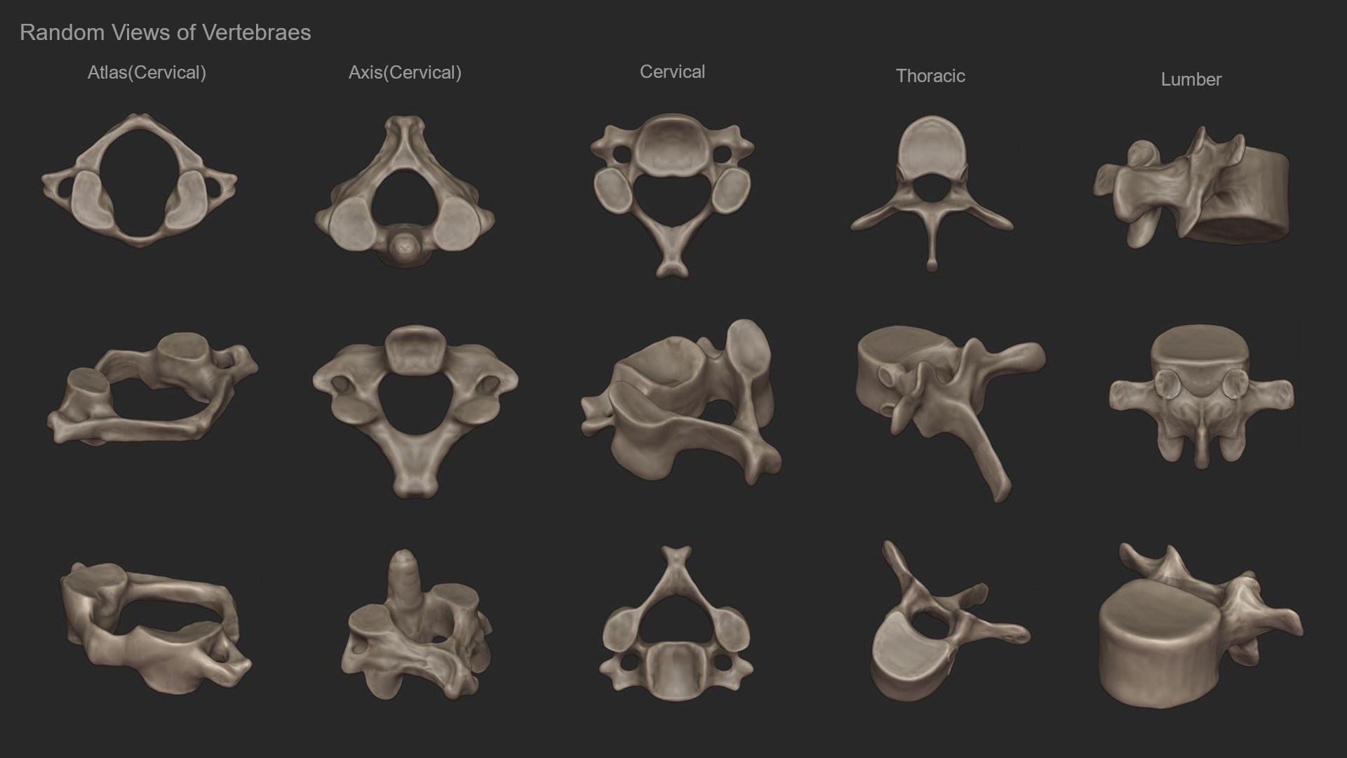 3D skeletal torso model https://p.turbosquid.com/ts-thumb/gz/JkoTcg/a7sbGdXv/vertebreas_1/jpg/1569424433/1920x1080/fit_q87/7765cd09f21985a661fd2e05cc78b4a1017096a1/vertebreas_1.jpg