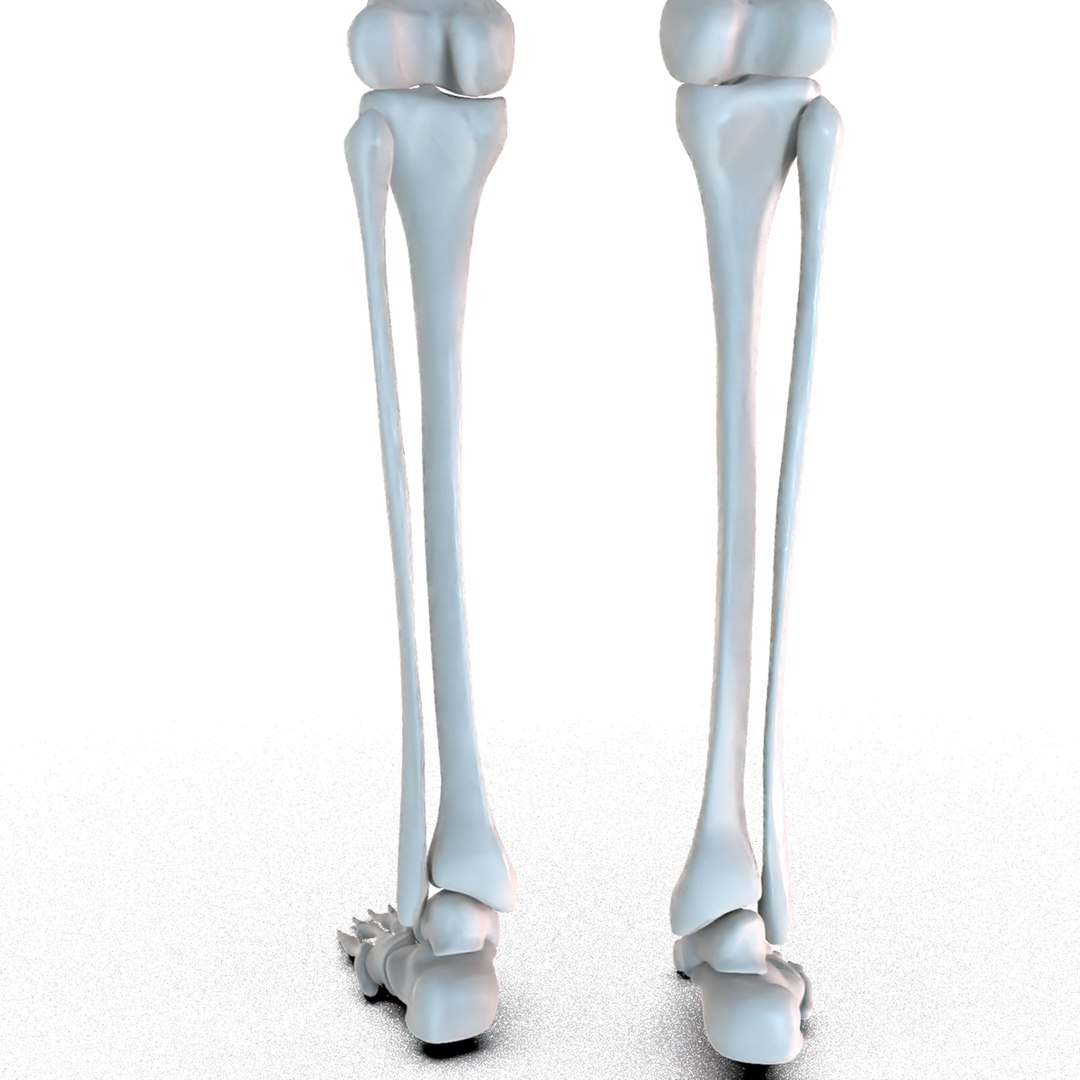 Hip Replacement Implant Installed Model - Turbosquid 1507568