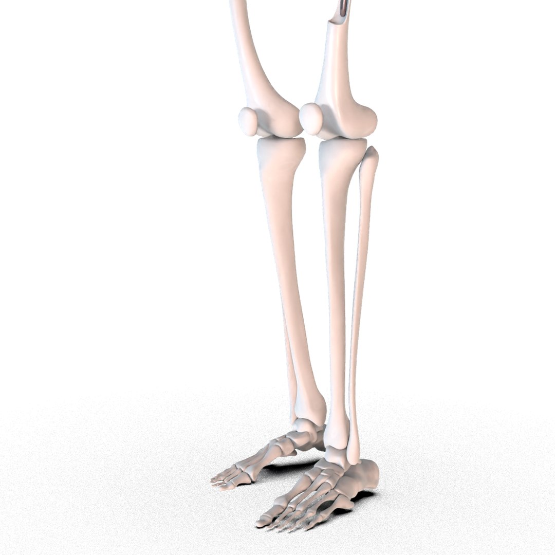 Hip replacement implant installed model - TurboSquid 1507568