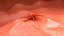 cancer cell 3D