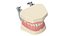 Dental Anatomy Educational Pediatric Kit with Removable Open Bite Teeth