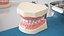 Dental Anatomy Educational Pediatric Kit with Removable Open Bite Teeth