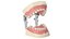 Dental Anatomy Educational Pediatric Kit with Removable Open Bite Teeth