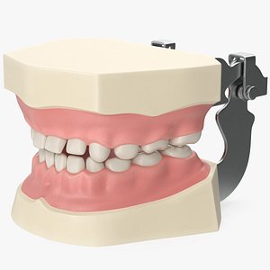 Dental Anatomy Educational Pediatric Kit with Removable Open Bite Teeth
