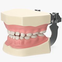 Dental Anatomy Educational Pediatric Kit with Removable Open Bite Teeth