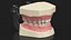 Dental Anatomy Educational Pediatric Kit with Removable Open Bite Teeth