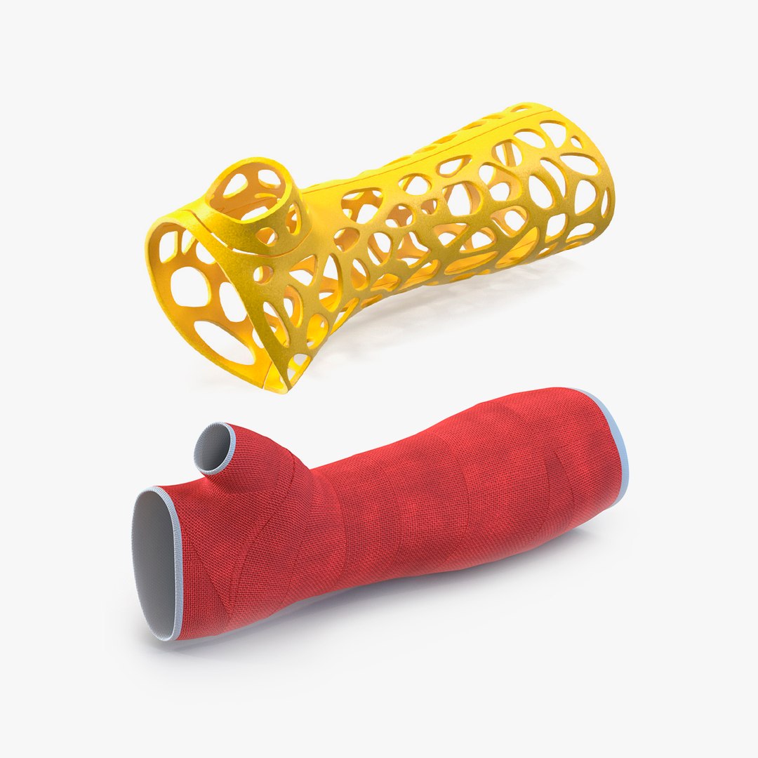 3D Orthopedic Casts Arm Collection TurboSquid 2054836   Orthopediccastsarmcollection3dmodel000 