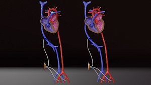 PDA Patent Ductus Arteriosus vs Normal blood circulation 3D model
