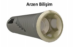 dental implant 3d model