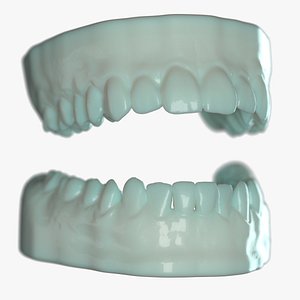 3D Dentures D Mold