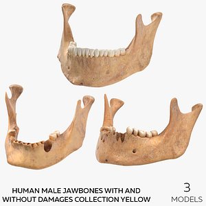 Human Male Jawbones With And Without Damages Collection Yellow - 3 models
